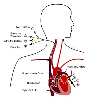 pulmonary_artery_catheter_english